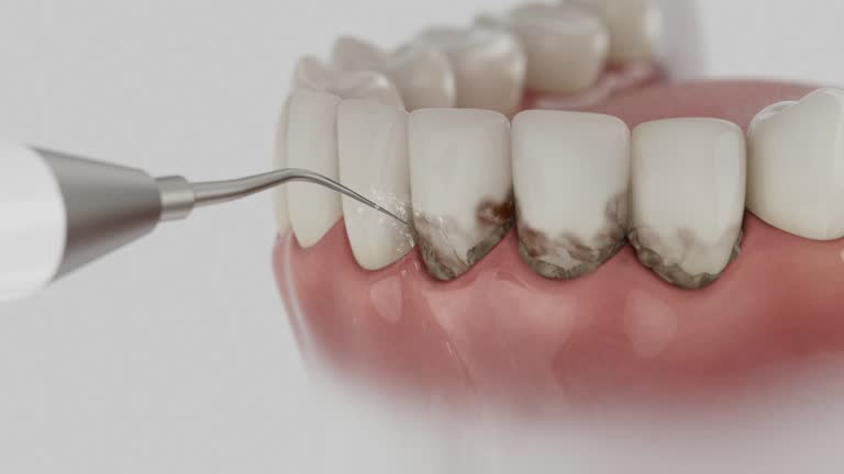 Reliable Emergency Dentist contractor in Springdale, NC by Smile Center Dentistry